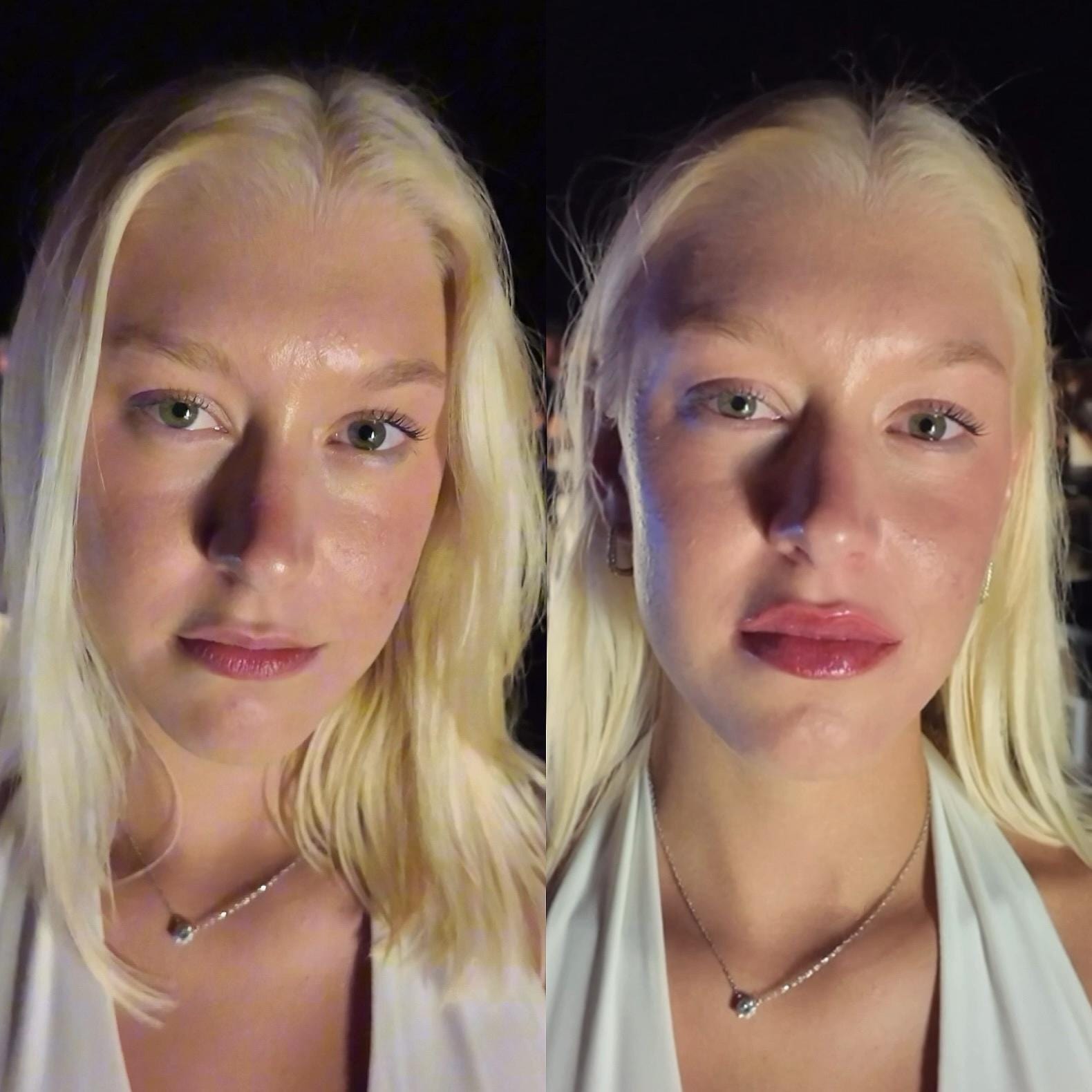 Vorher Nachher Blonde junge Frau