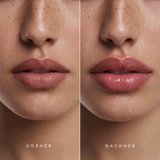 Premium Korean Peptide Lip Plumper
