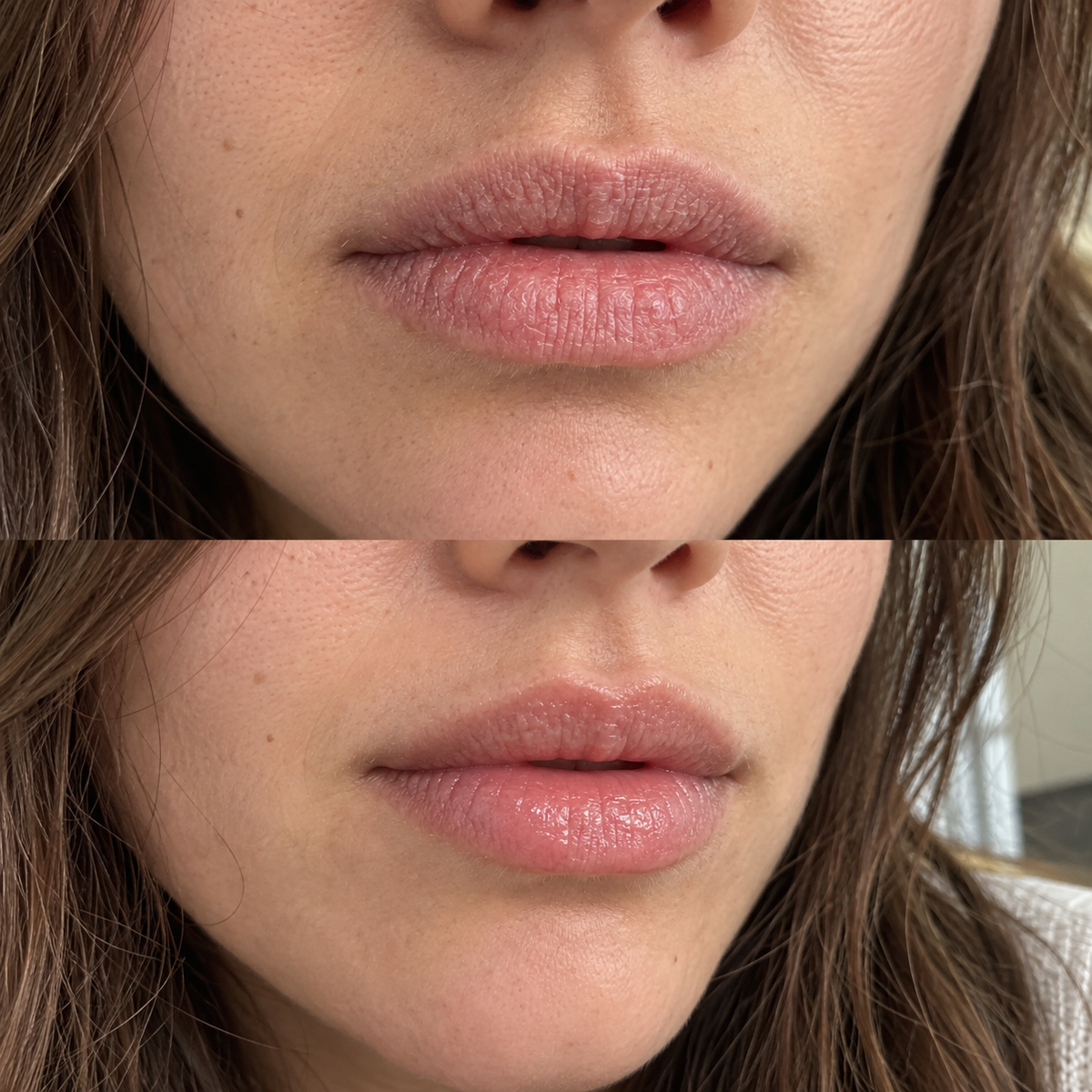 Lippen vor und nach der Anwendung, ohne Make-up